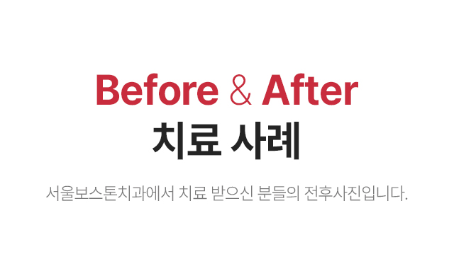 Before & After 치료사례 서울보스톤치과에서 치료받으신 분들의 전후사진 입니다.